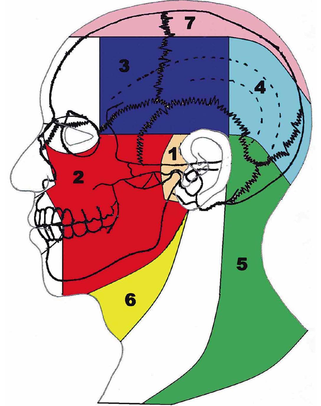 Pain Drawing Rdc (PDF) Frequency˚˚ and˚˚ Location˚˚ of˚˚ Referred˚˚ Pain