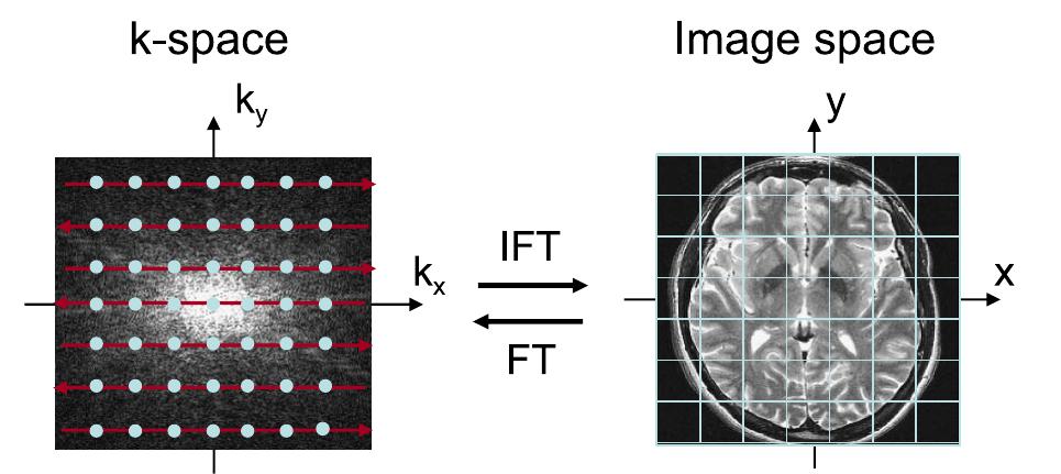 (PDF) Statistical Analysis of fMRI Data