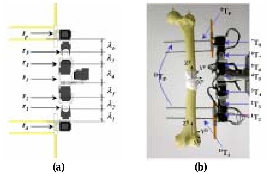 Revolute Systems (PDF) A Prototype of Robotic External Fixation System for Surgery of ...