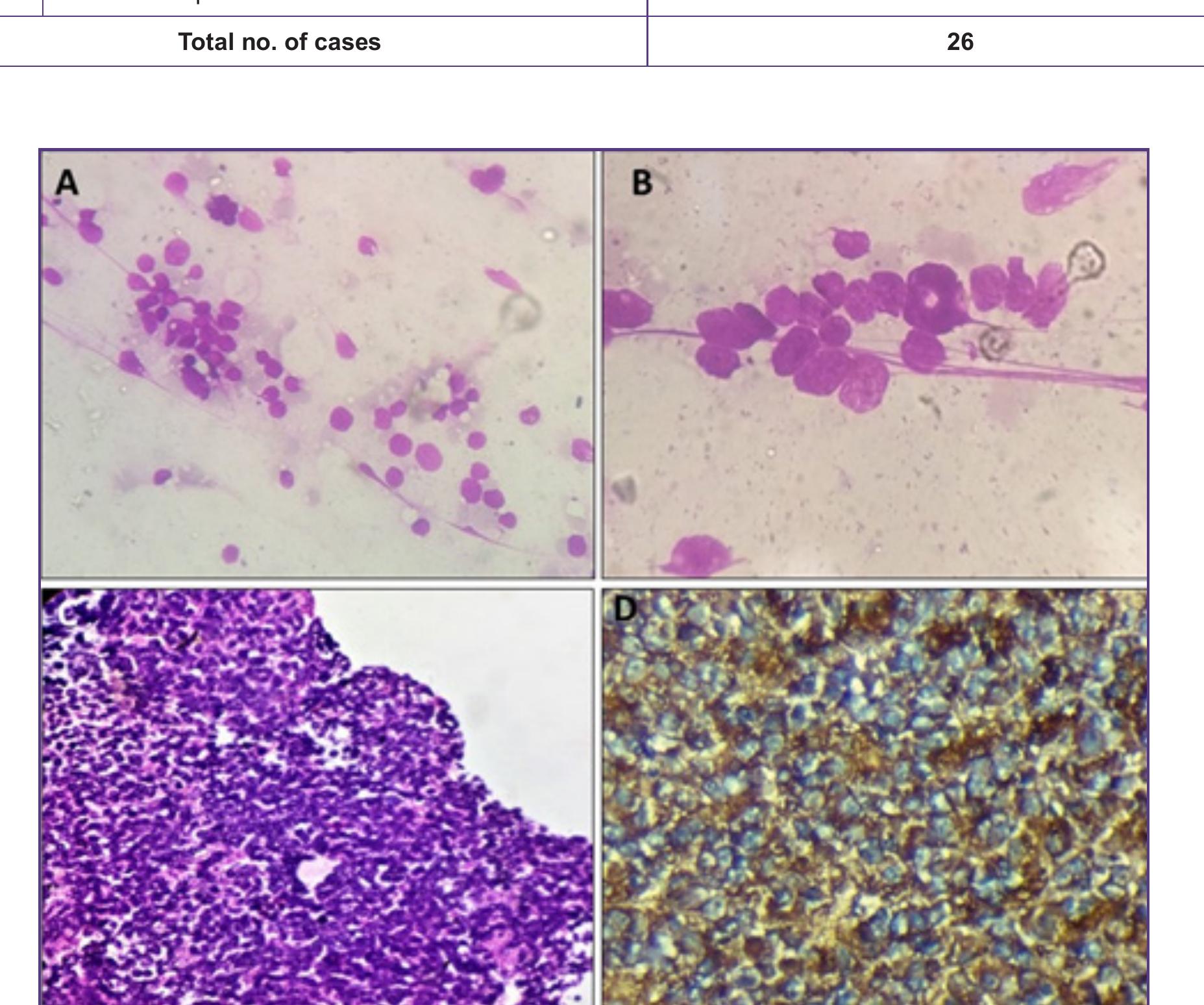(PDF) Bone Marrow Cytomorphology And Clinico-Hematological Profile of ...