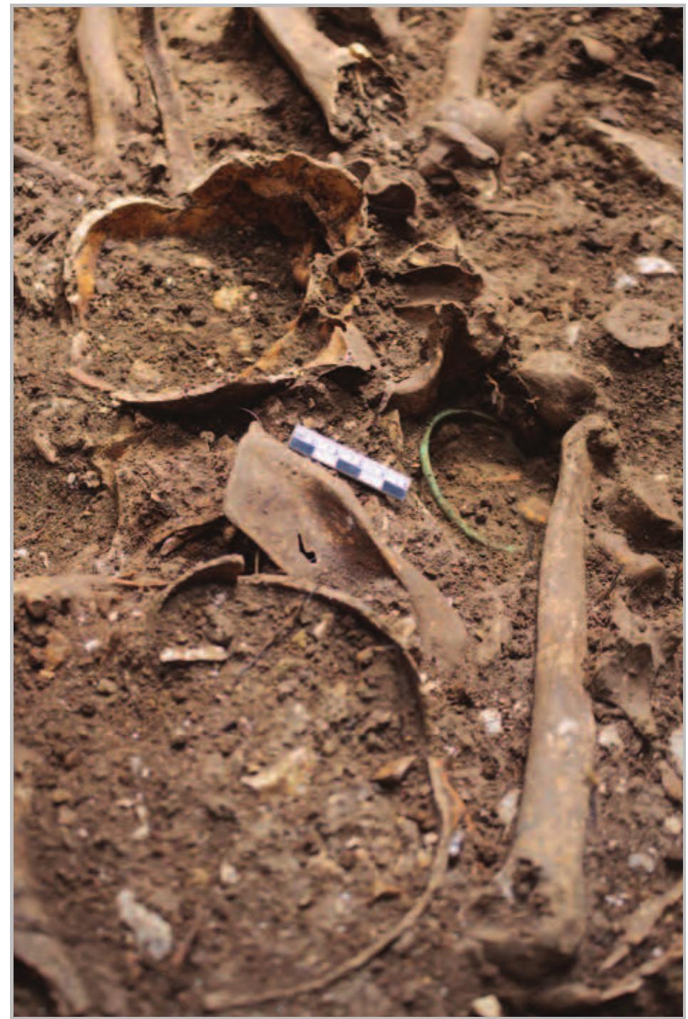 Fig. 17- Area 2/3: upper bronze arm ring in situ around the wrist of a male individual.  fragments of a terracotta lamp and a few beads were  Tab. 2- Age and sex determination of human skeletons as well as the orientations of bodies and limb positions and their stratigraphic relationships (AD= Adult, M=Male, I=Indeterminate, NS= North-south NA=Not available). 