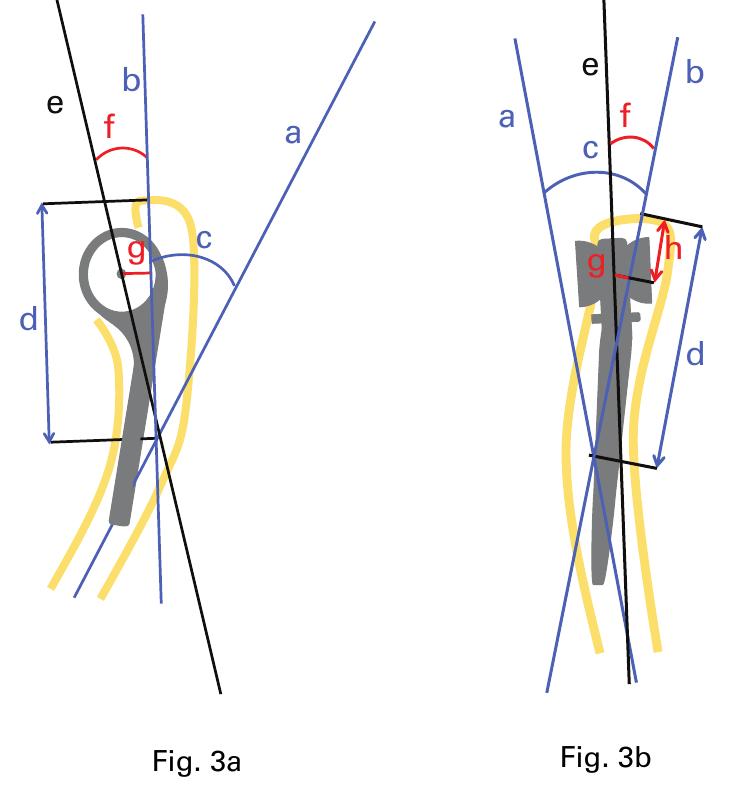 Figure 3 - from The effect of the anatomy of the distal