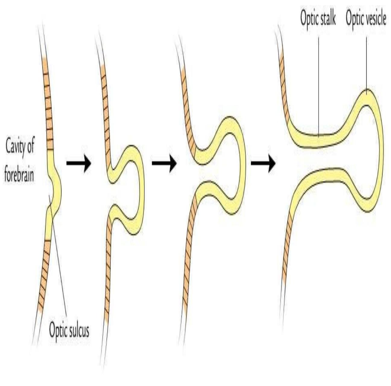 (PDF) THE ANATOMY AND DEVELOPMENT Of EYEBALL