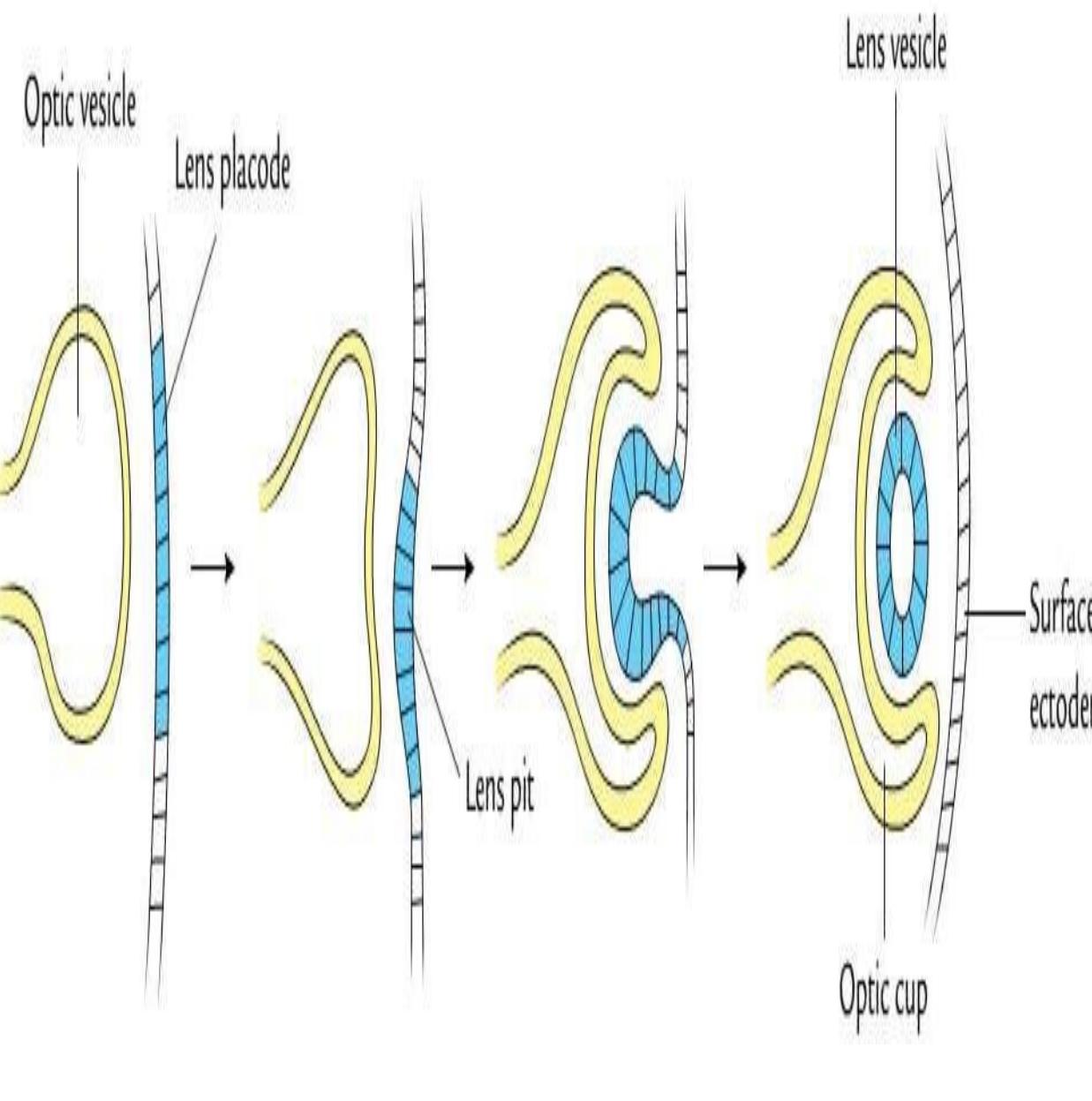 (PDF) THE ANATOMY AND DEVELOPMENT Of EYEBALL