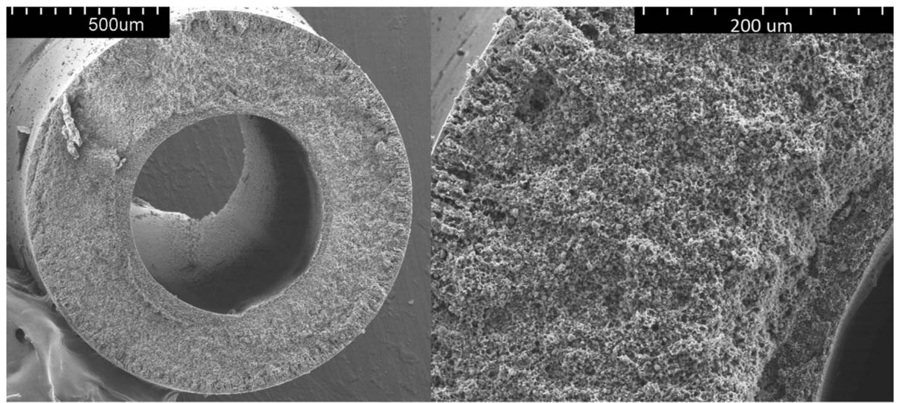 Sem images of the cross section of dual layer hollow fiber
