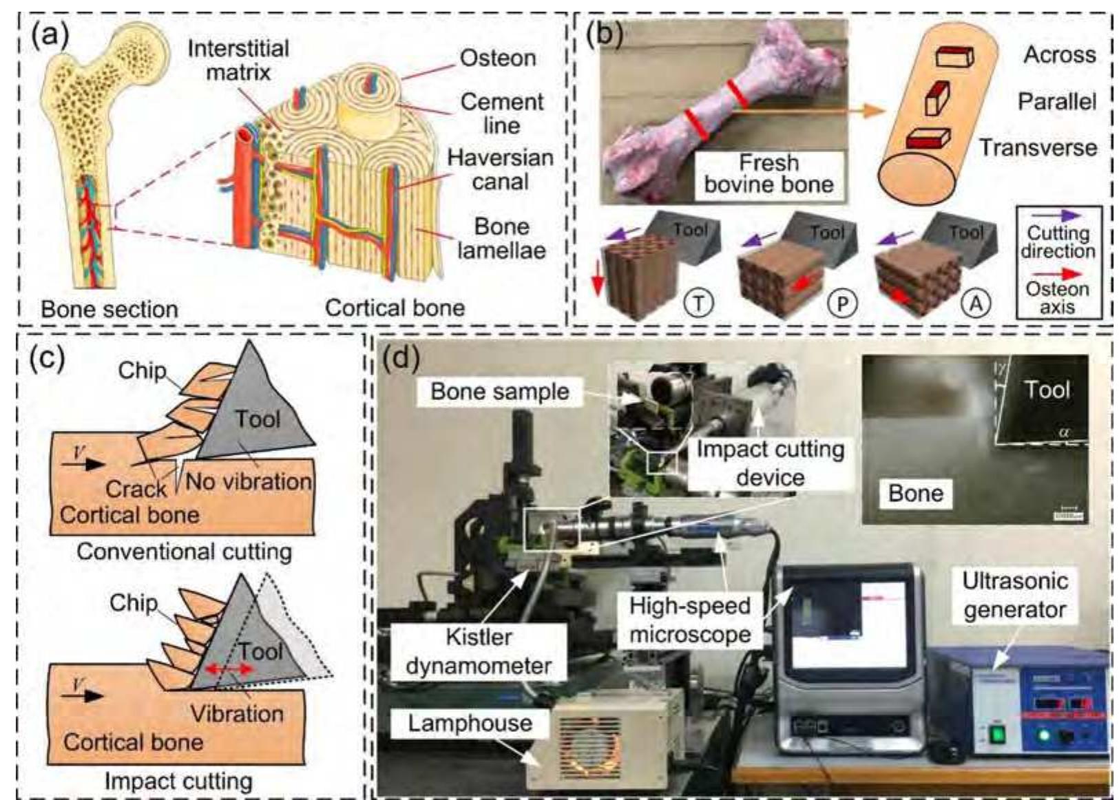 (PDF) Improvements of material removal in cortical bone via impact ...