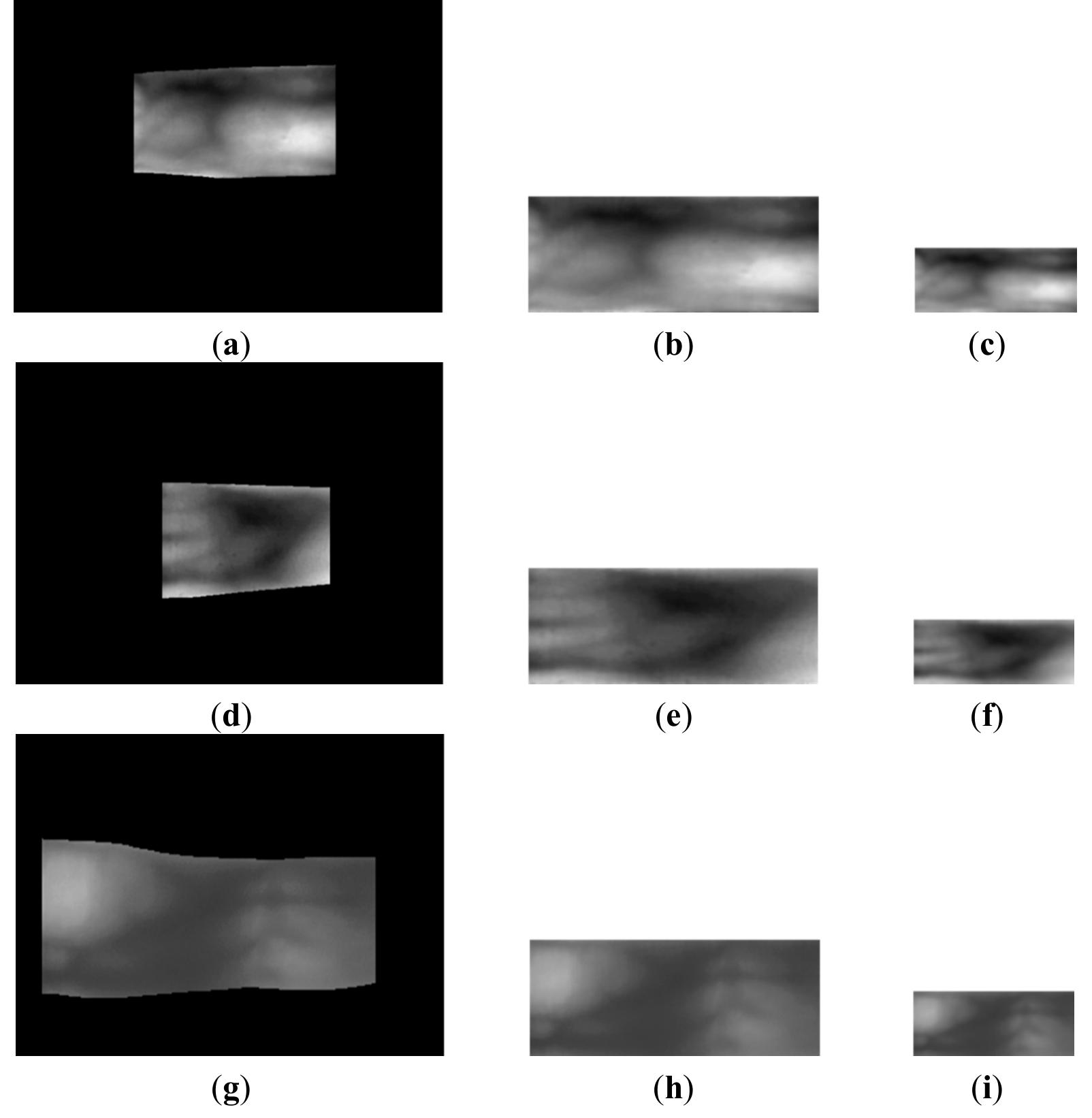 Figure 4 - Nonintrusive Finger-Vein Recognition System Using