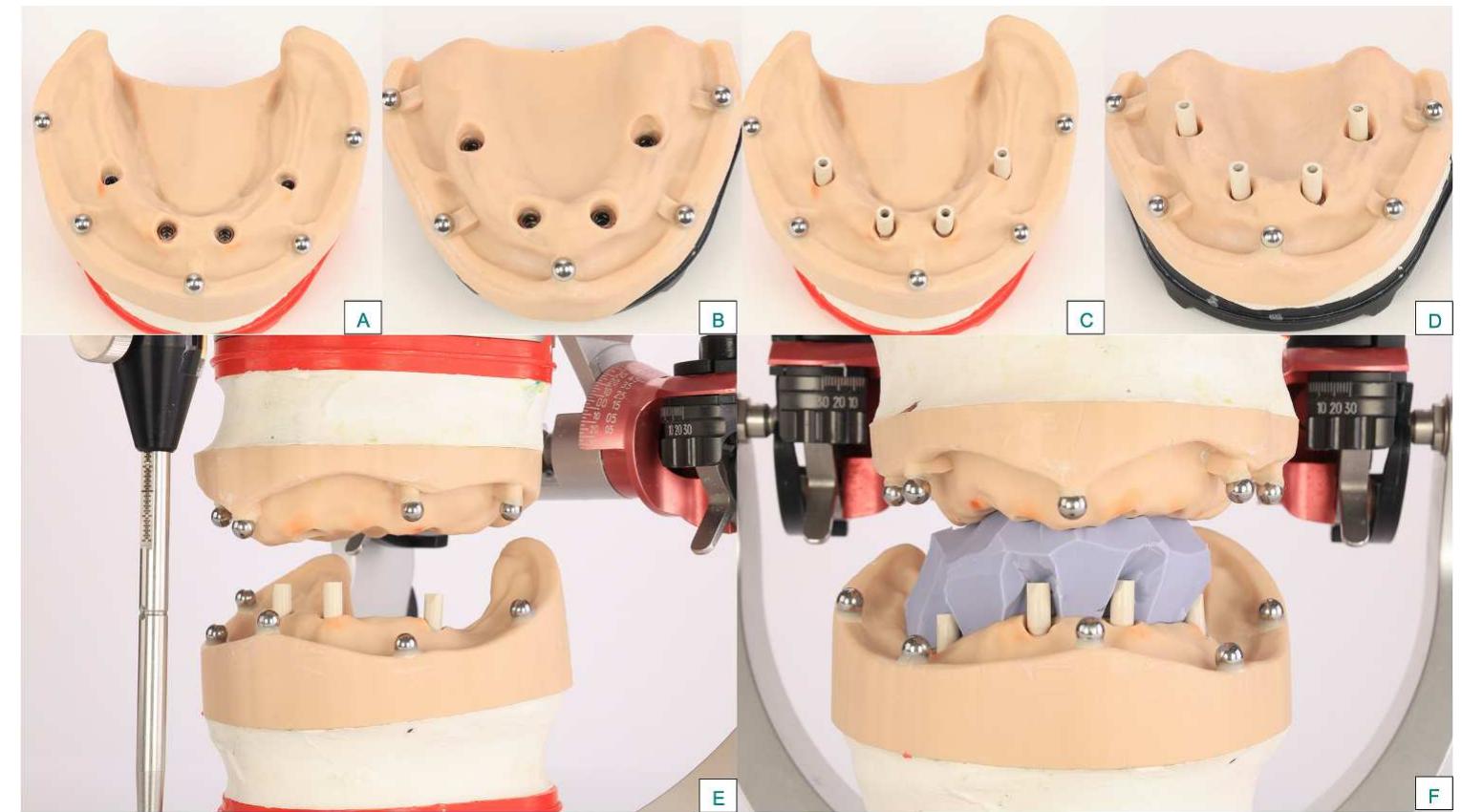 Partial Registration Rim (PDF) Effect of Different Intraoral Scanners on the Accuracy of Bite ...