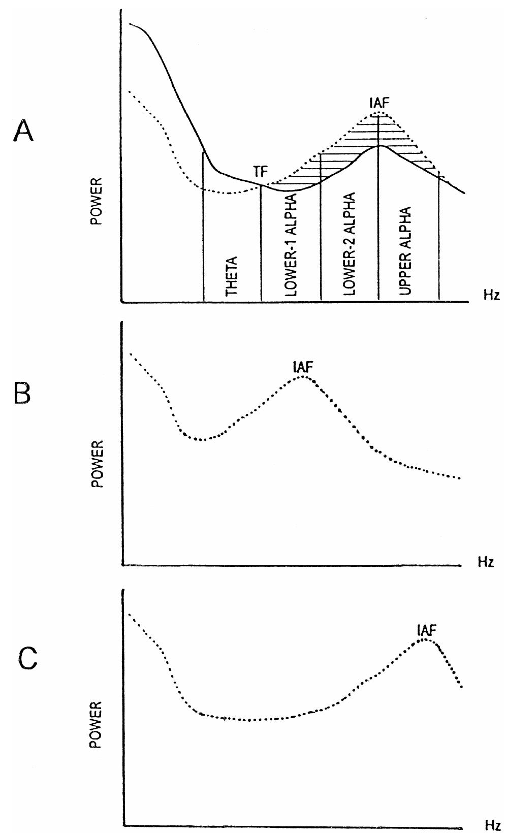 (PDF) EEG alpha and theta oscillations reflect cognitive and memory ...