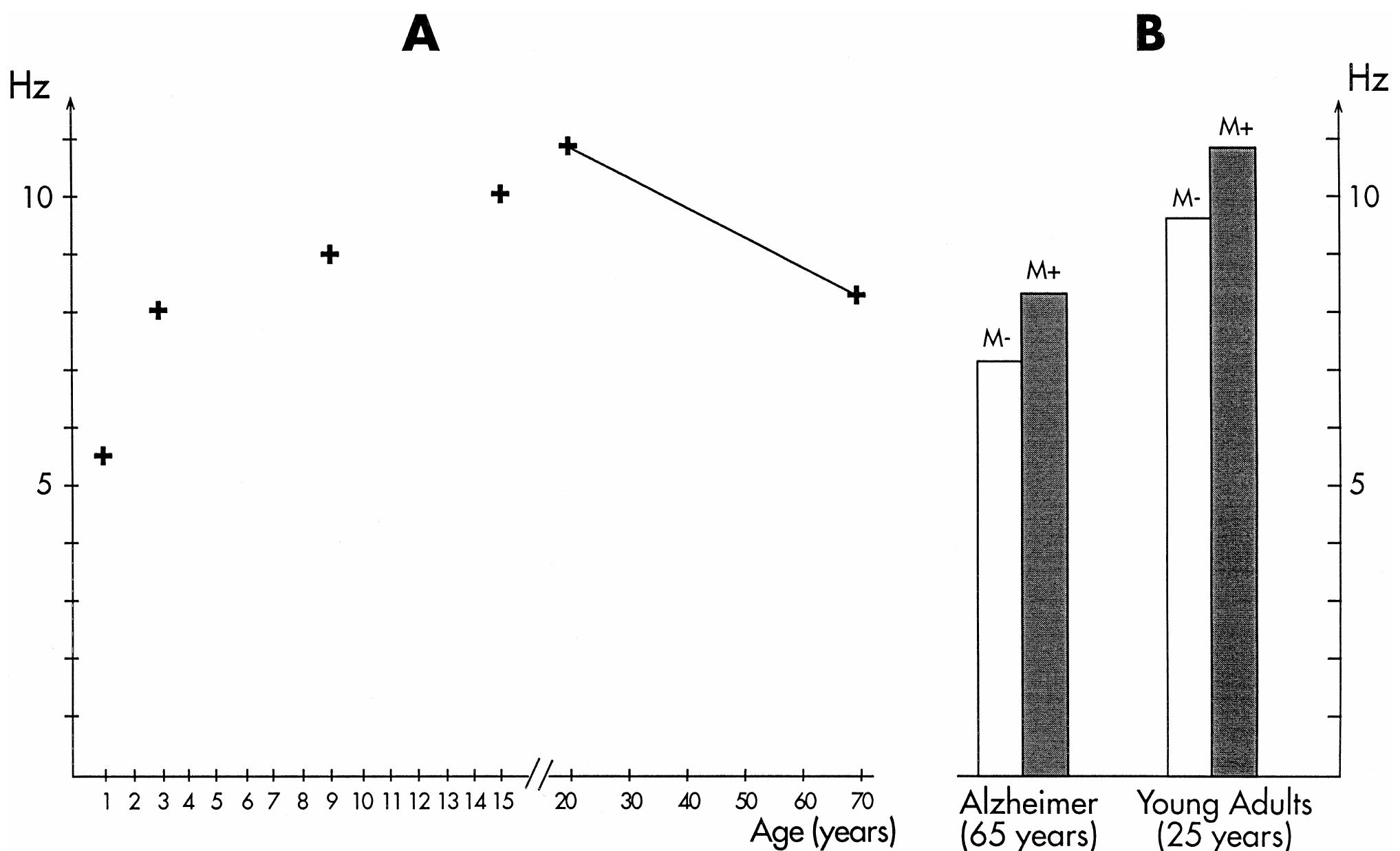 (PDF) EEG alpha and theta oscillations reflect cognitive and memory ...