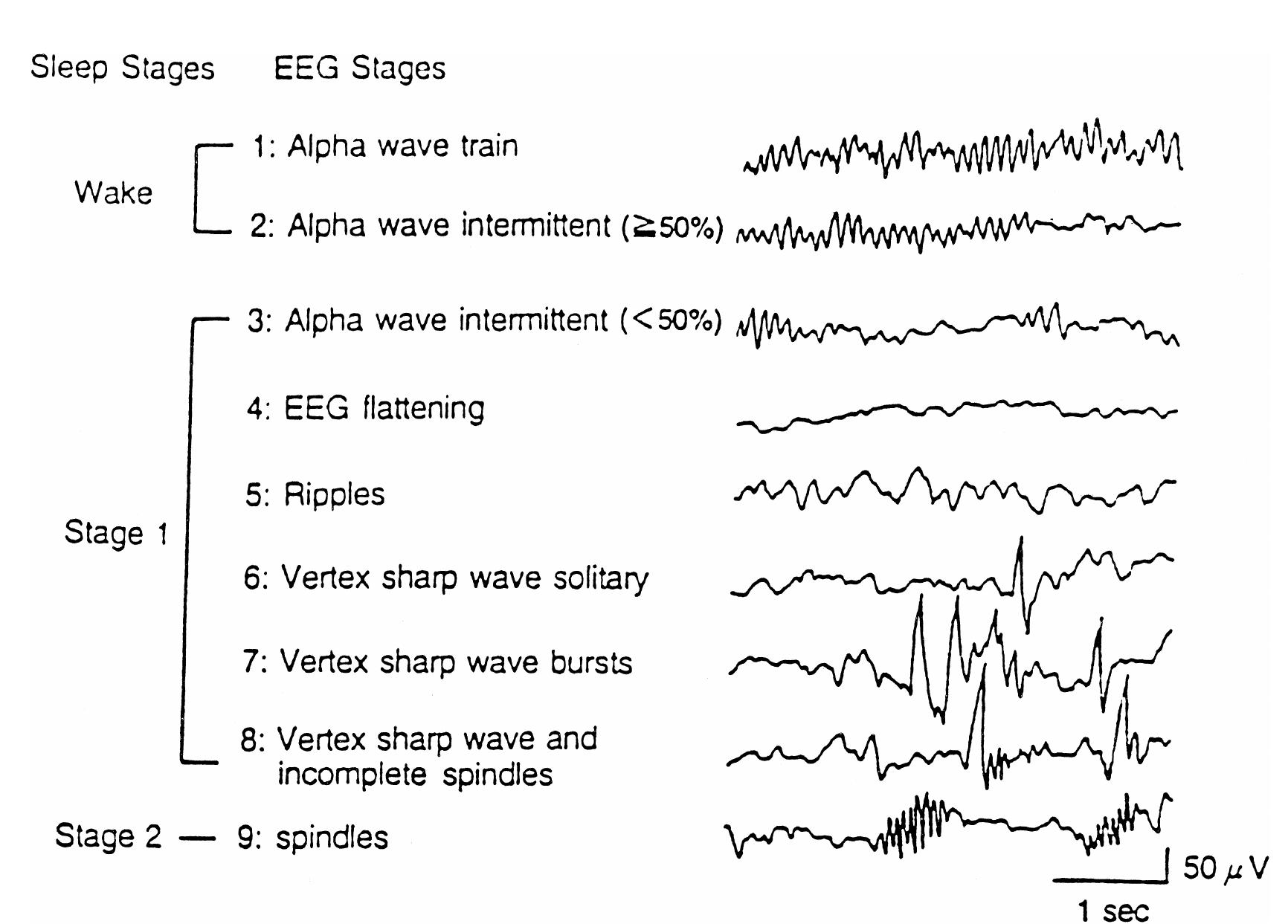 (PDF) EEG alpha and theta oscillations reflect cognitive and memory ...
