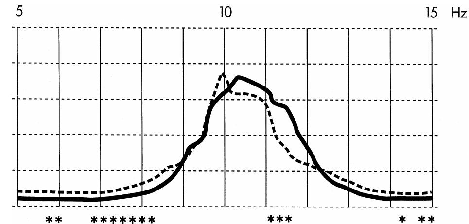 (PDF) EEG alpha and theta oscillations reflect cognitive and memory ...