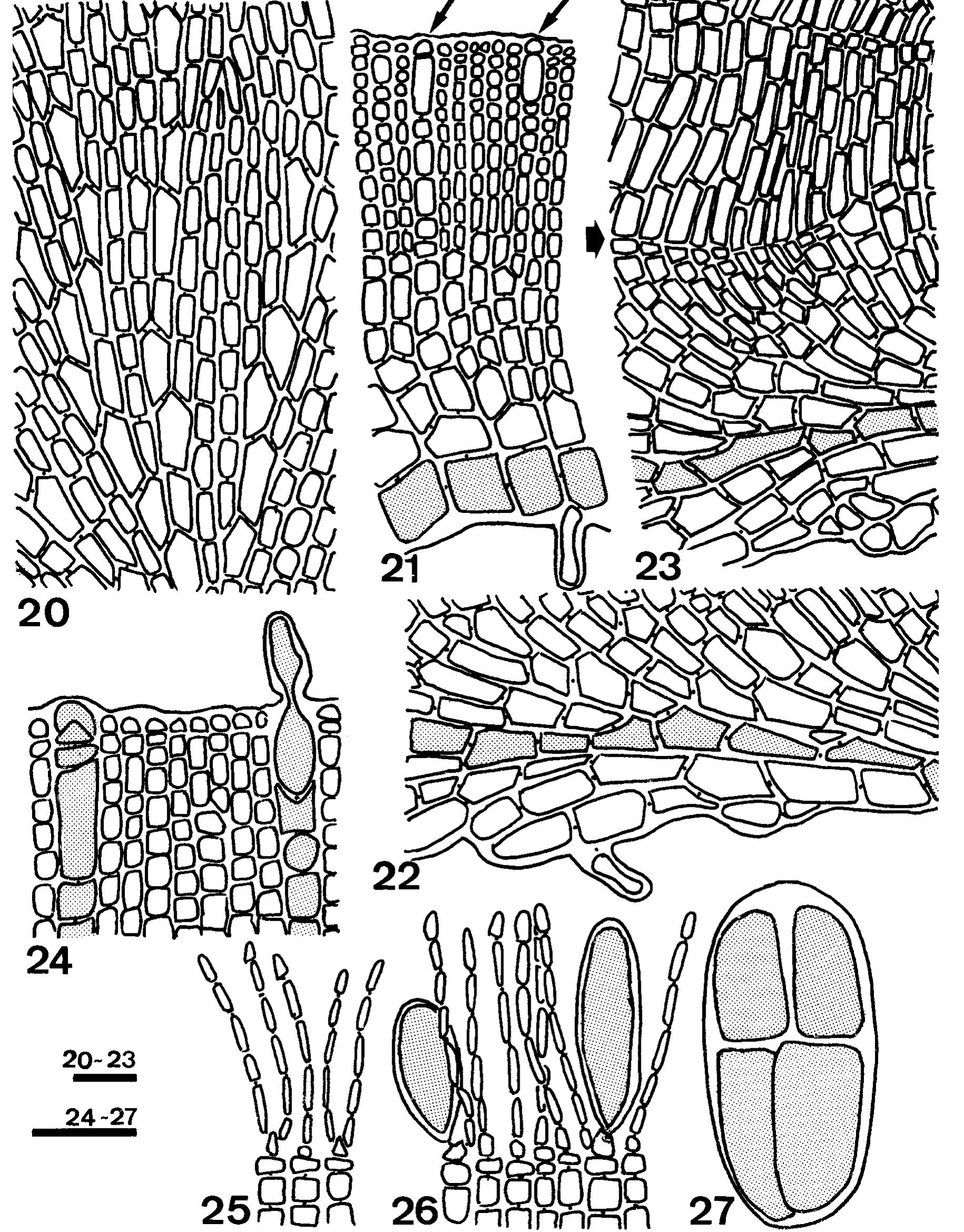 Rvs of thallus showing groups of cystoliths using darkfield