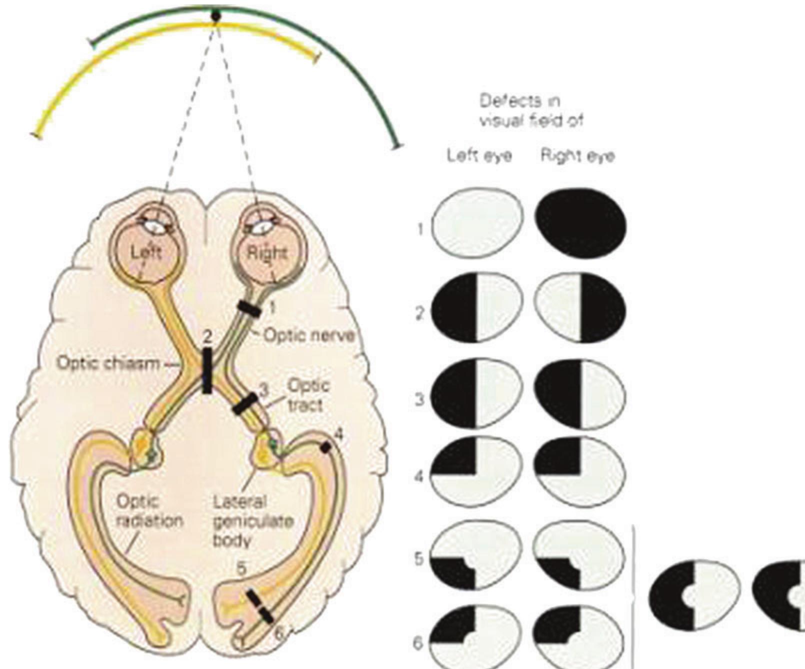 Field to the left visual cortex. the figure depicts visual