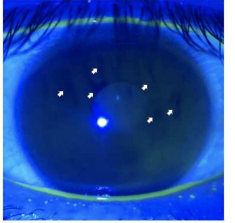 Figure 8 - from Artificial intelligence to estimate the tear
