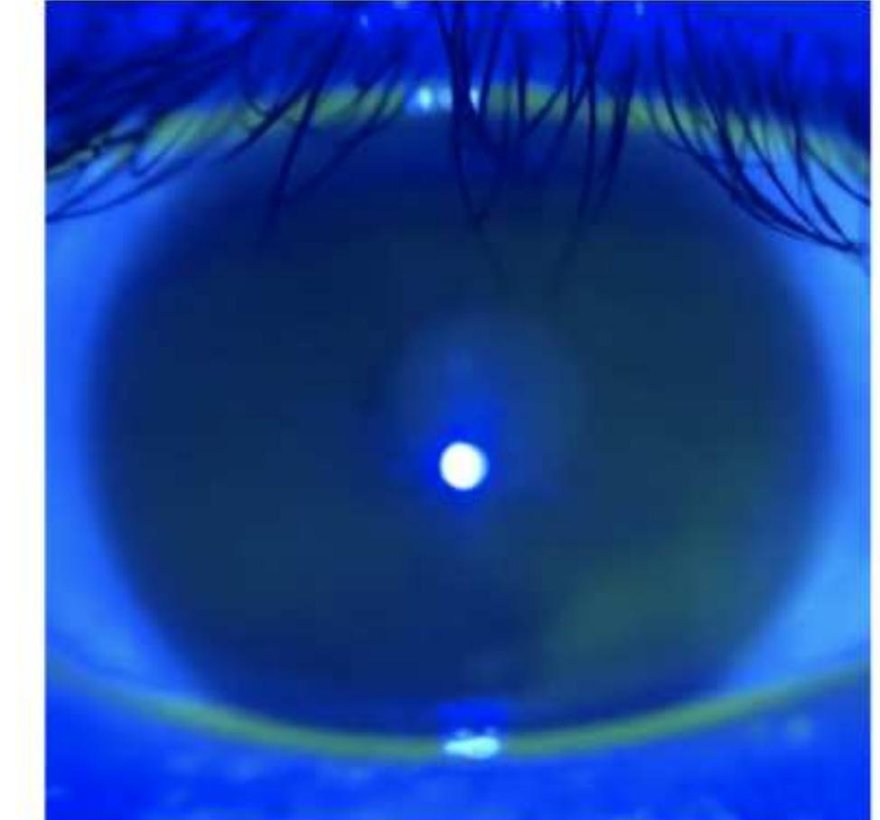 Figure 8 - from Artificial intelligence to estimate the tear