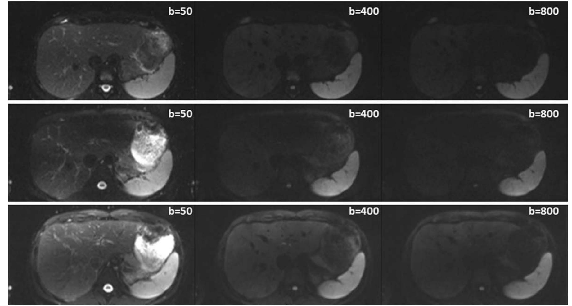 (PDF) Clinical applications of dual-channel transmit MRI: A review