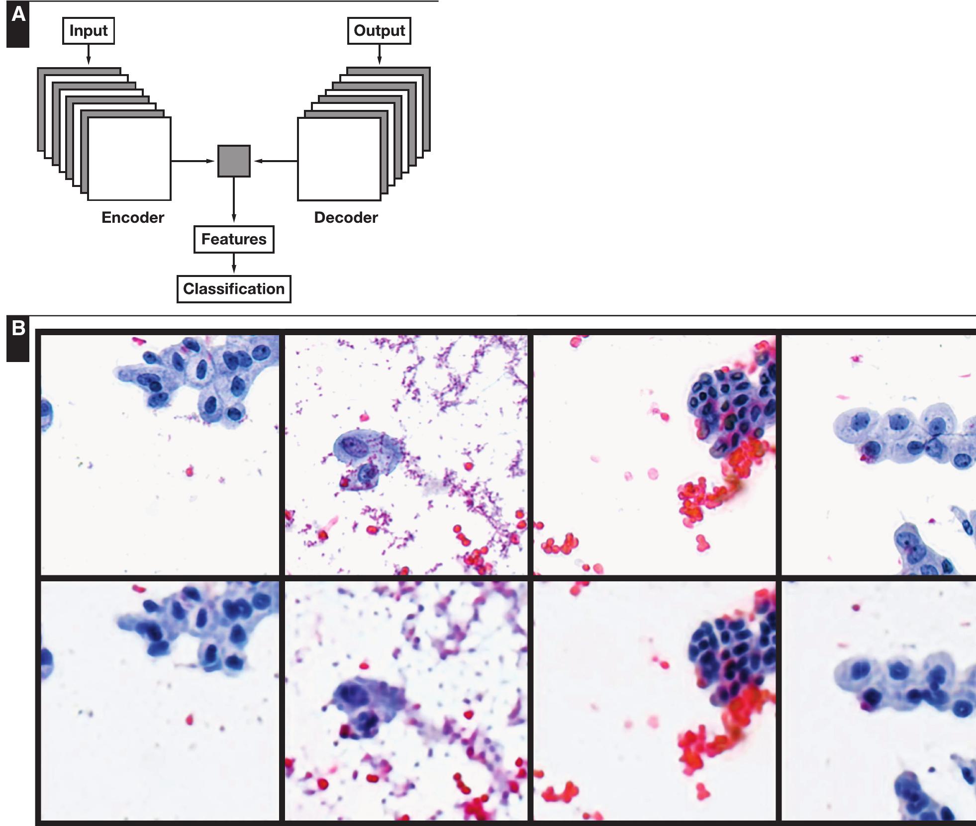 (PDF) The Utility of Unsupervised Machine Learning in Anatomic Pathology