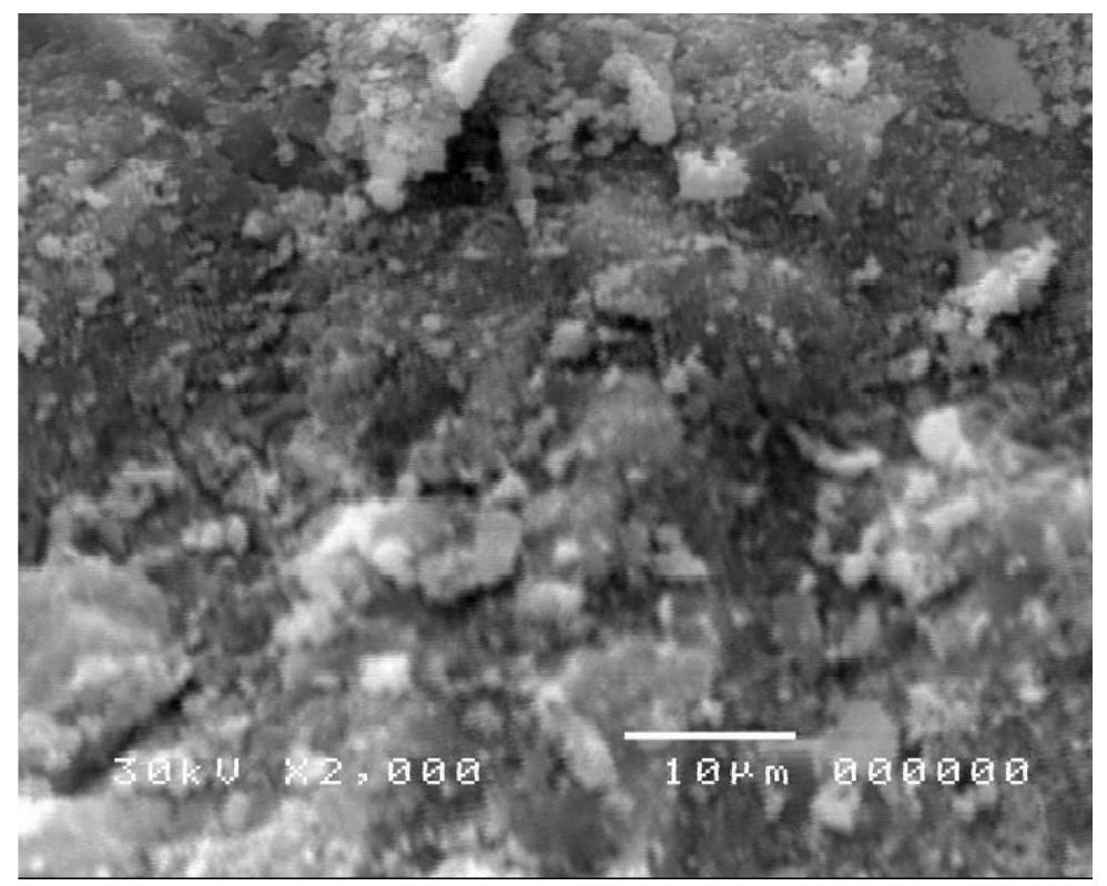 (PDF) Evaluation of gamma ray attenuation properties of normal concrete ...