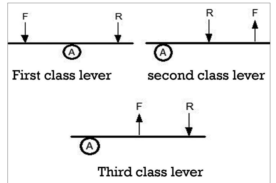 Classes of lever arm principle based on the position of the