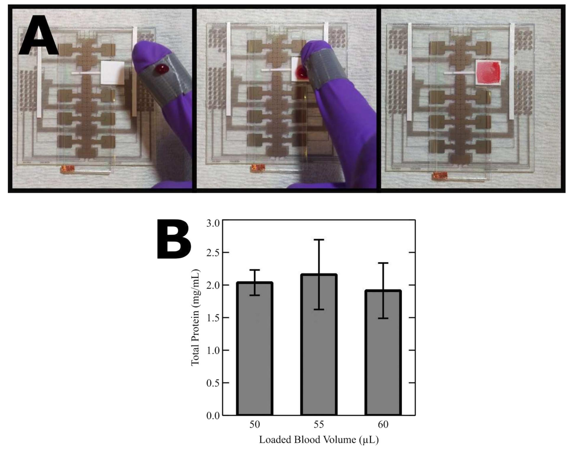 (PDF) Direct loading of blood for plasma separation and diagnostic ...