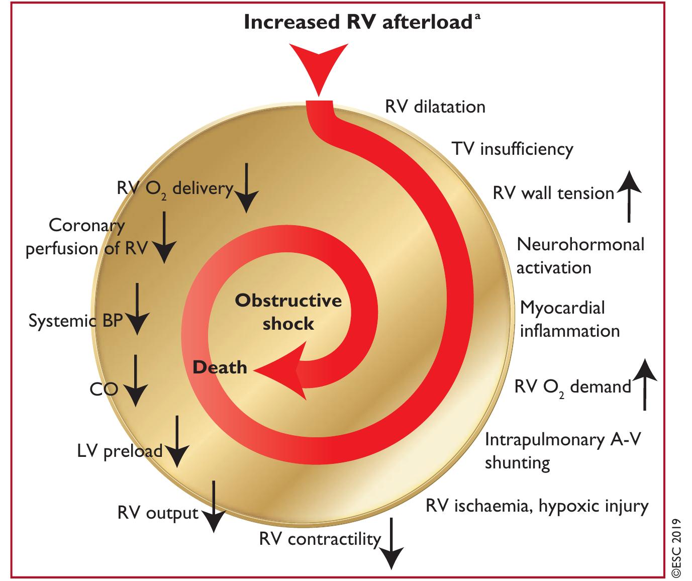 (PDF) 2019 ESC Guidelines for the diagnosis and management of acute ...
