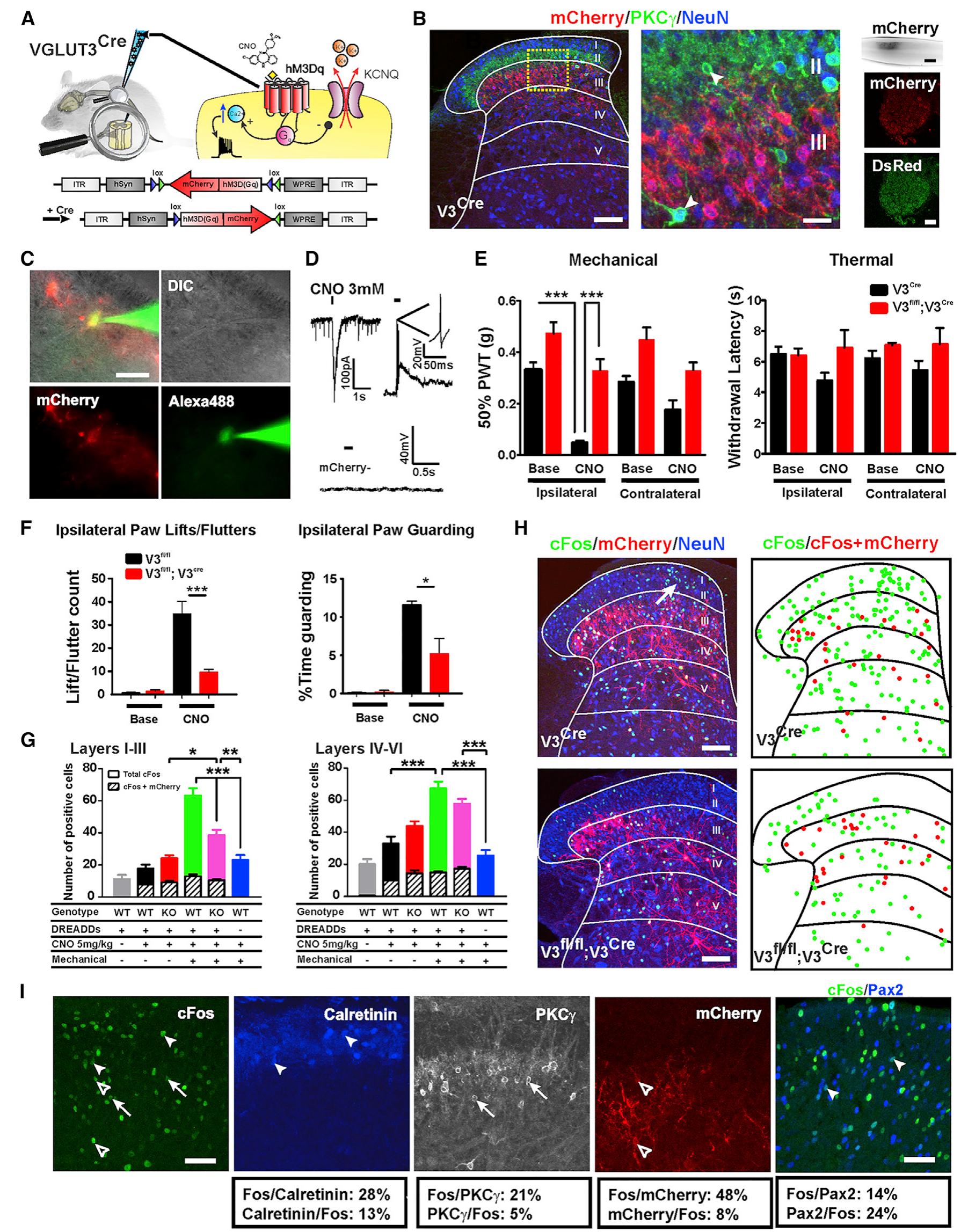 Polysynaptic Circuit (PDF) Dorsal Horn Circuits for Persistent Mechanical Pain