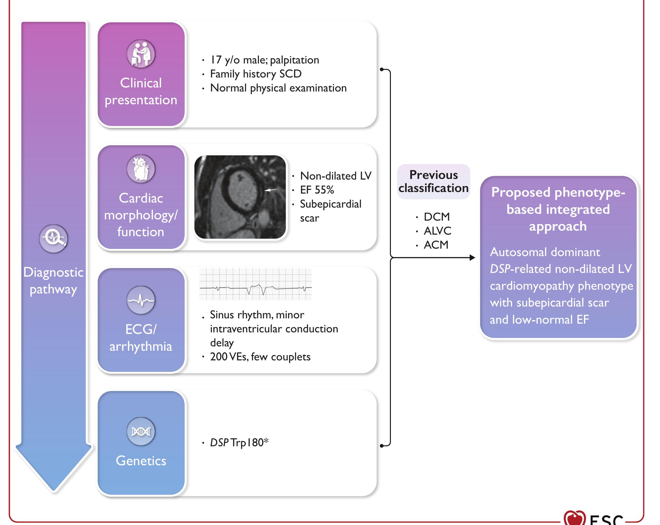 Cmr, cardiac magnetic resonance; dsp, desmoplakin; ecg,