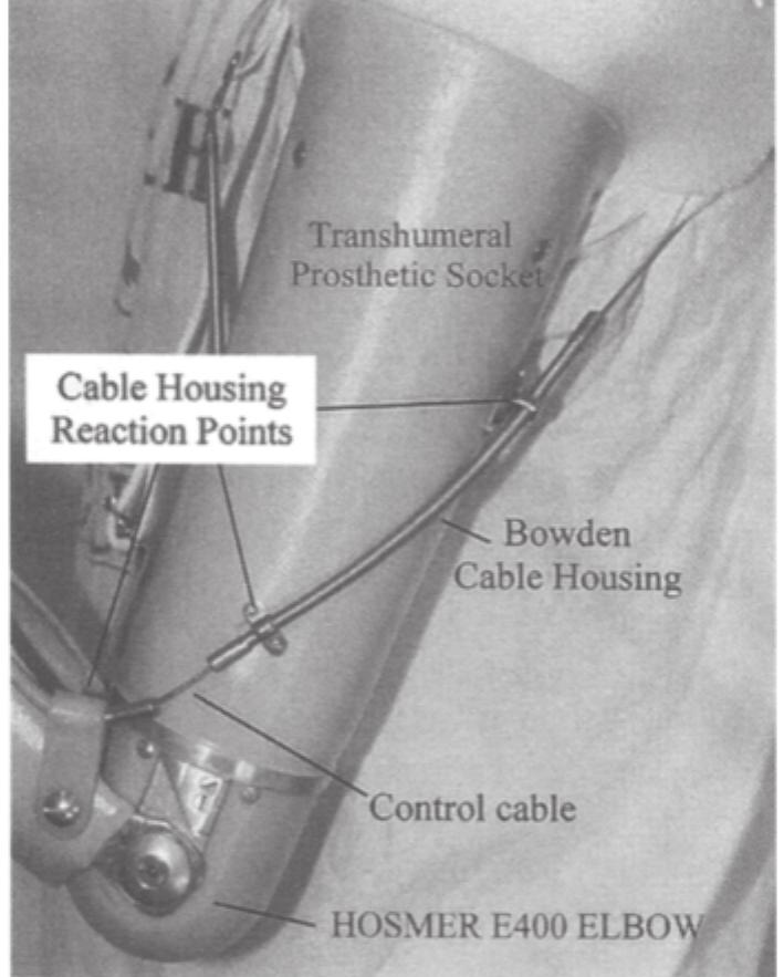 (PDF) DESIGN OF ARTIFICIAL ARMS AND HANDS FOR PROSTHETIC APPLICATIONS