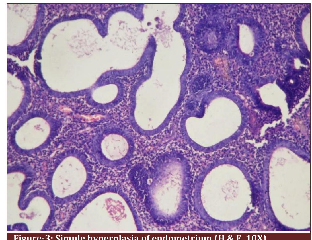 (PDF) Histopathological interpretation of endometrium in abnormal ...