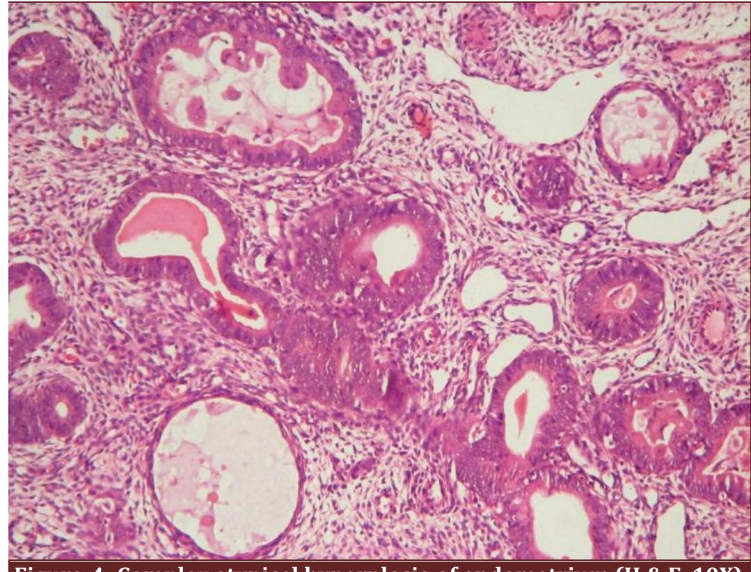 (PDF) Histopathological interpretation of endometrium in abnormal ...