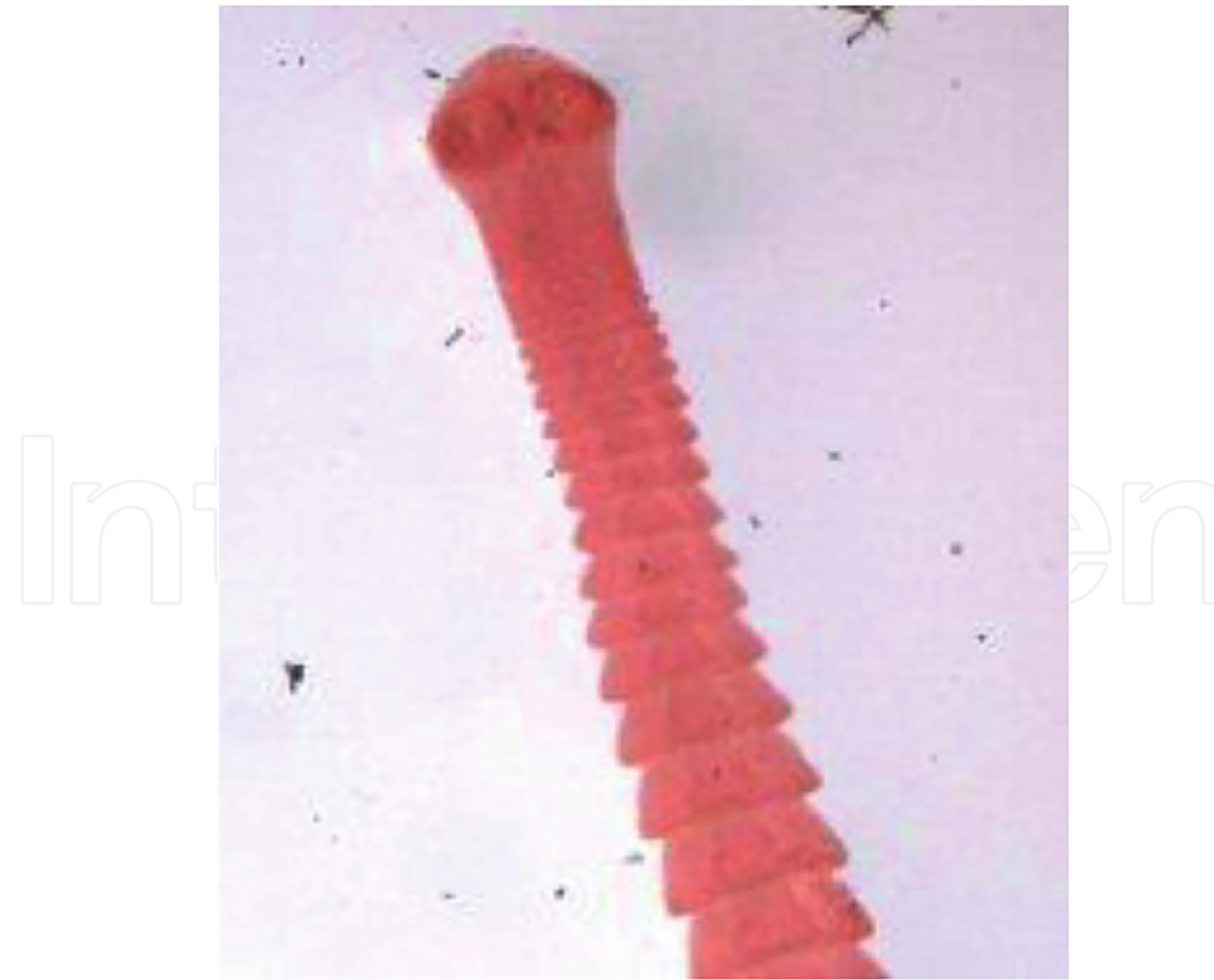 Figure 5.  > ae  Scolex of Raillietina tetragona 336x448 pixels [32].  Cestode in the small intestine of chicken [32].  Figure 4. 
