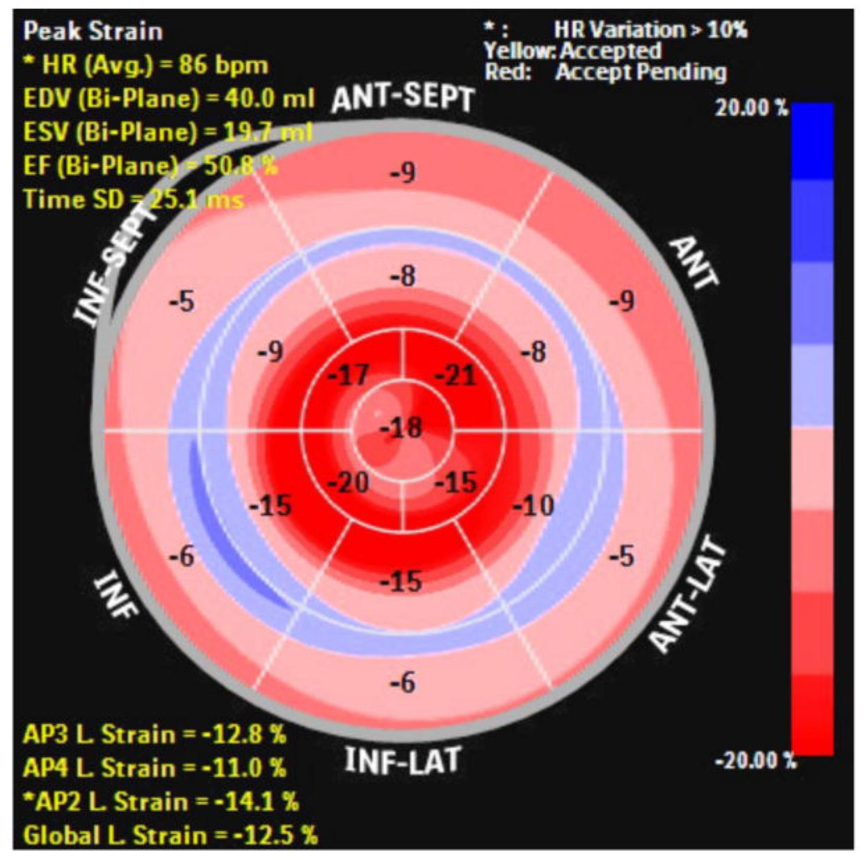 (PDF) Cardiac amyloidosis: An update on pathophysiology, diagnosis, and ...
