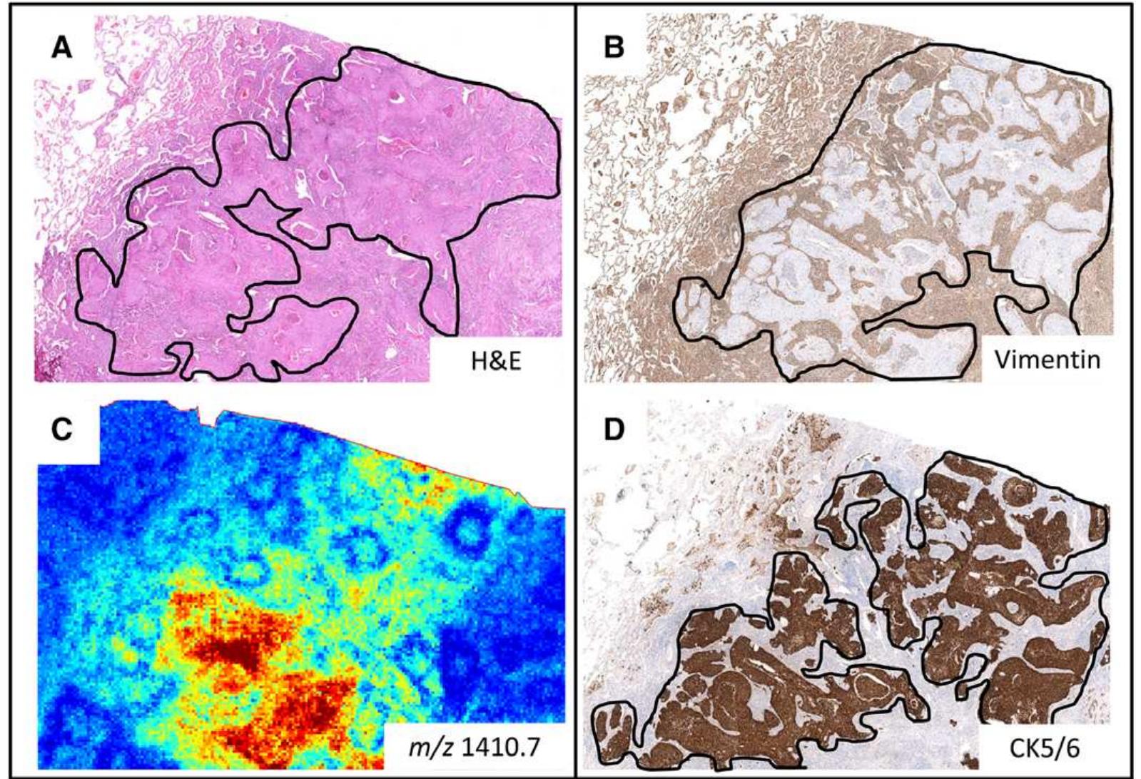 (PDF) Proteomics in Pathology