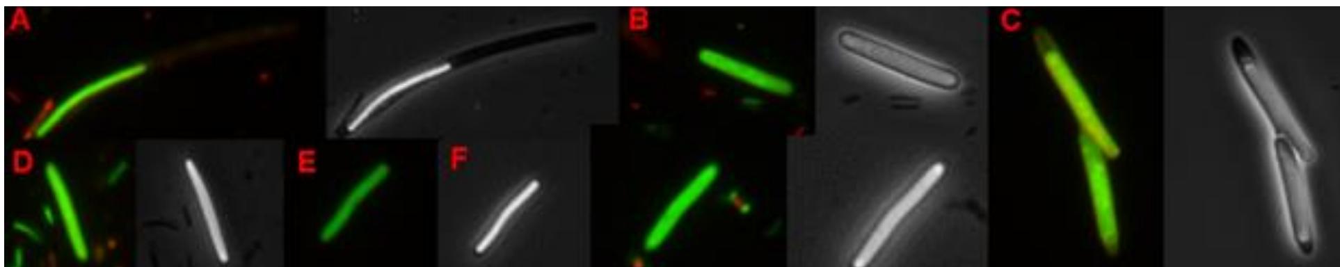 Representative cells from the live/dead staining of heat