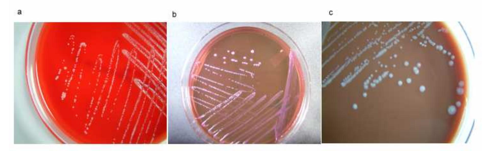 (PDF) Blood Infection by Mycobacterium Chelonae in a Uremic Diabetes ...