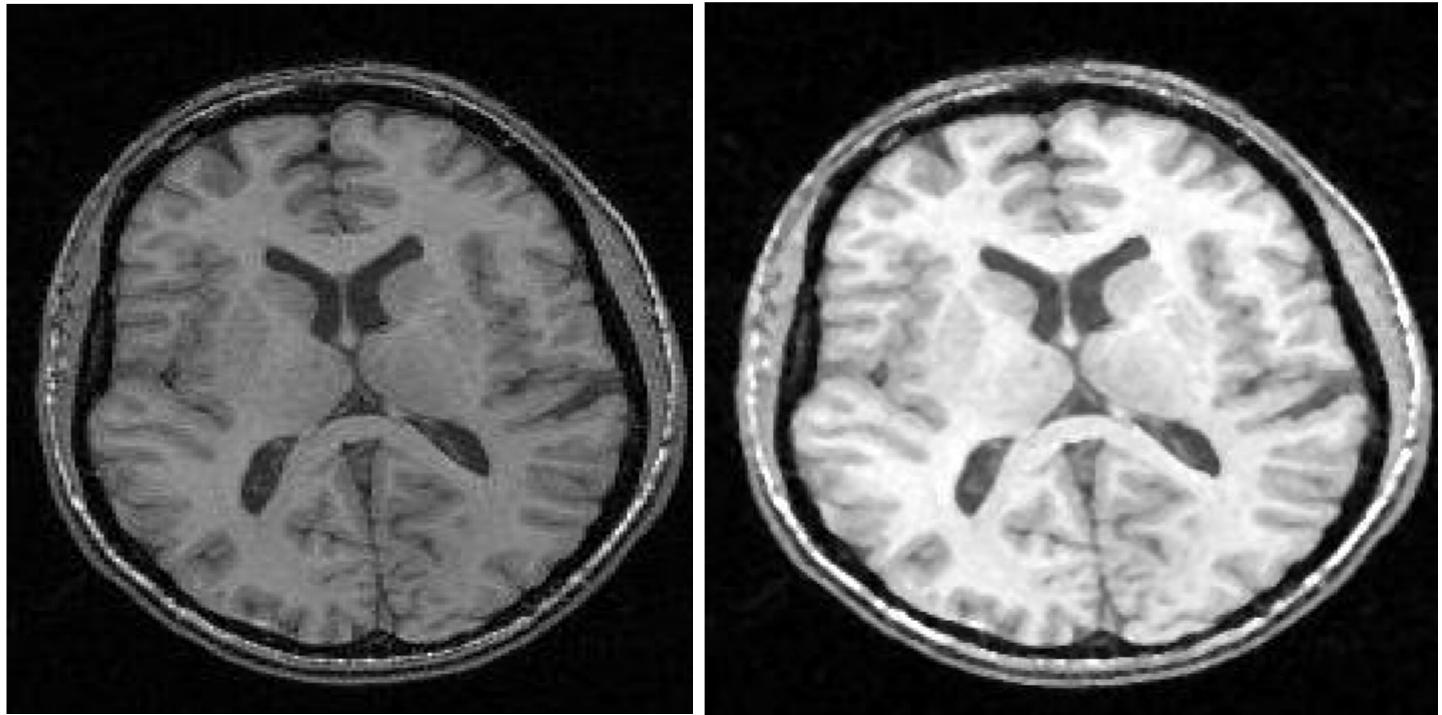 Original mri image [9] figure 2. mri image after