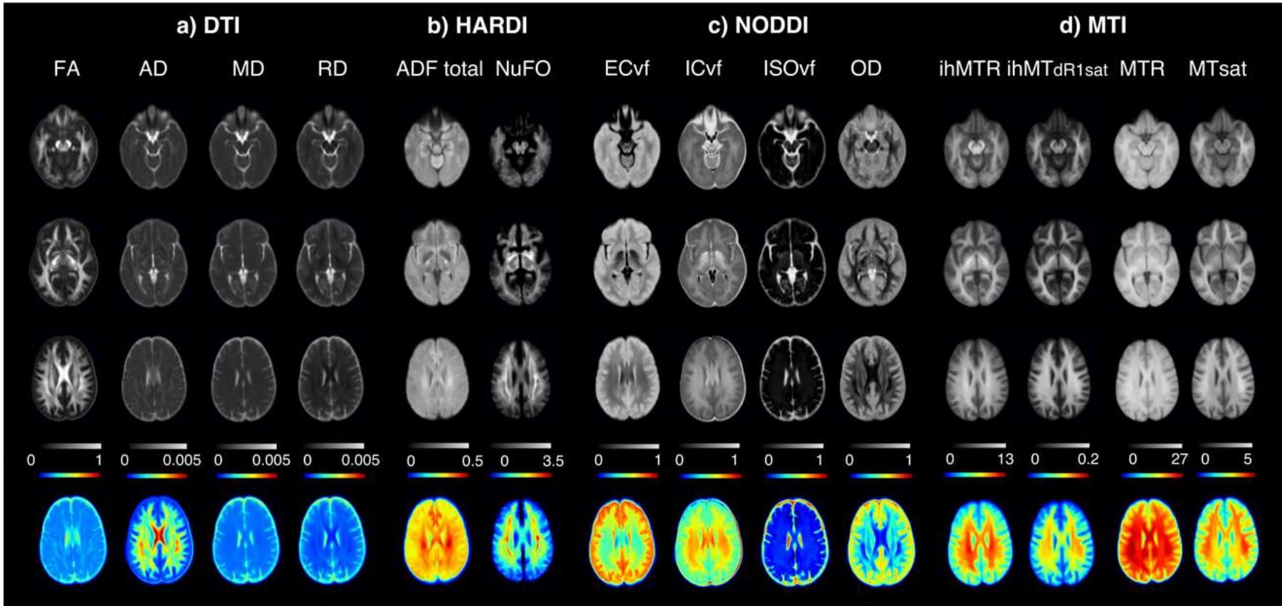 Md Diffusivity Microstructural maps, in a) dti measures including fa