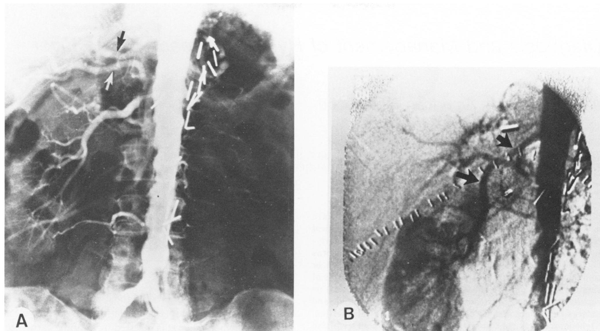 (PDF) Use of the Hepatic Circulation for Renal Revascularization