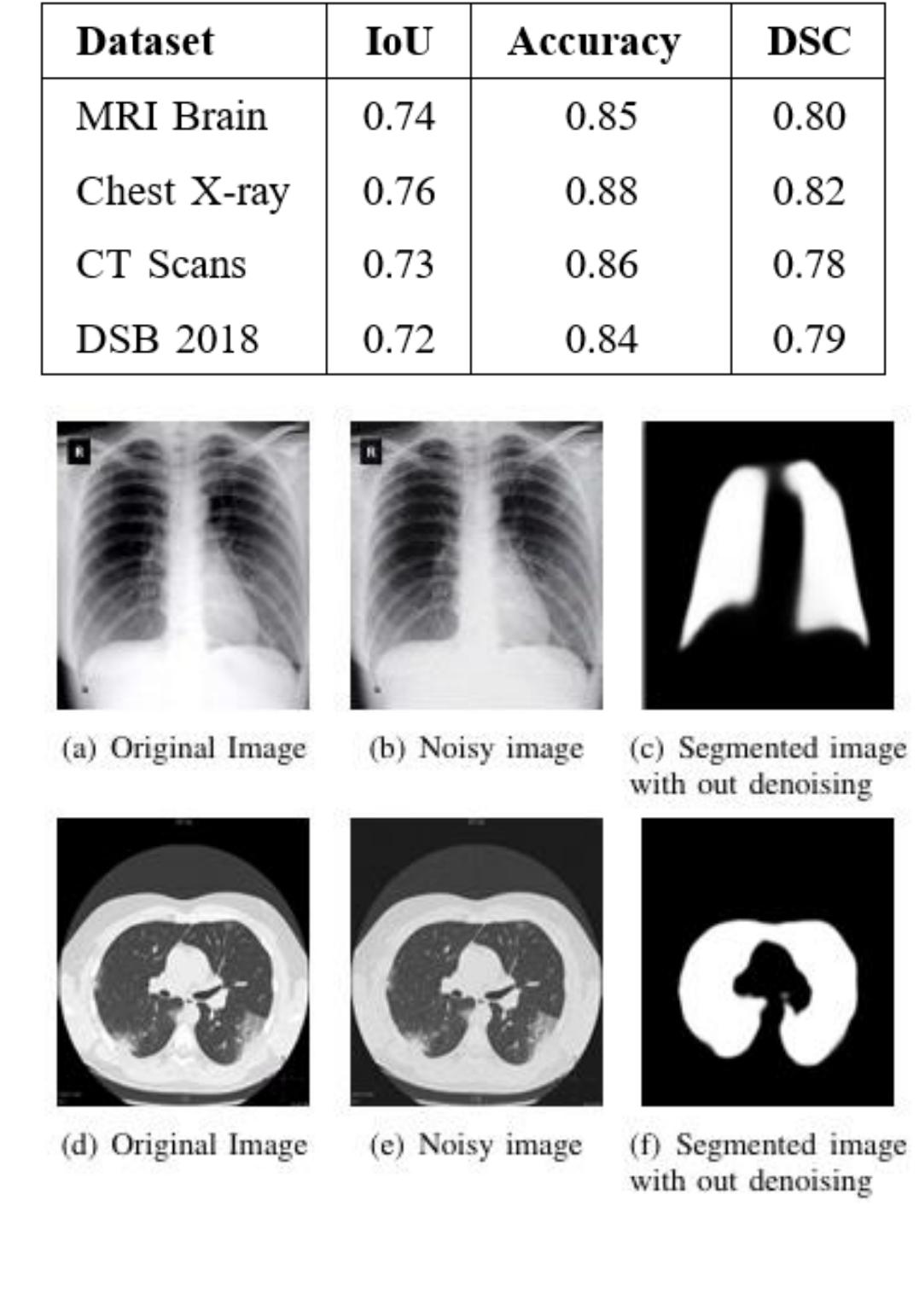 TABLE I: Segmentation Results for U-Net 