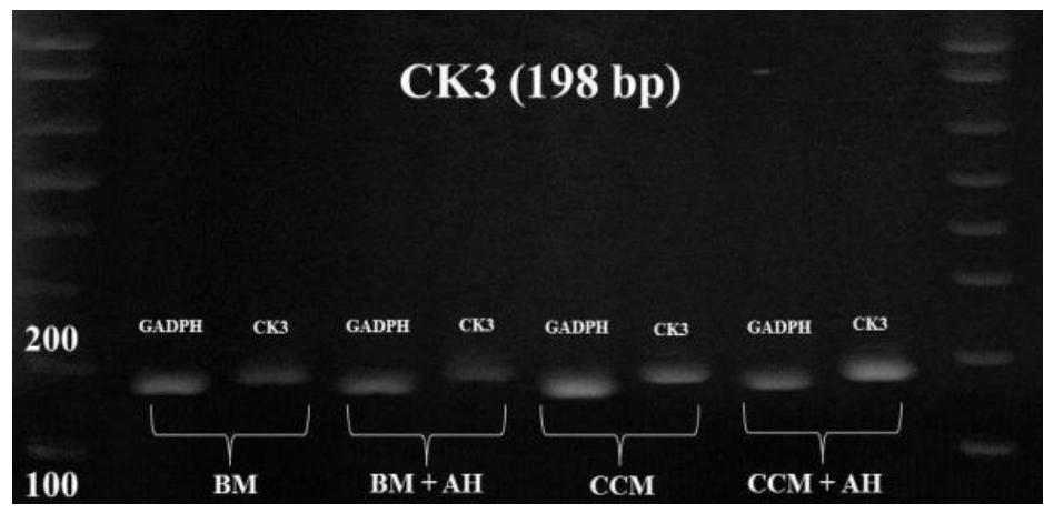 Gel electrophoresis of cultured cec phenotype with gadph