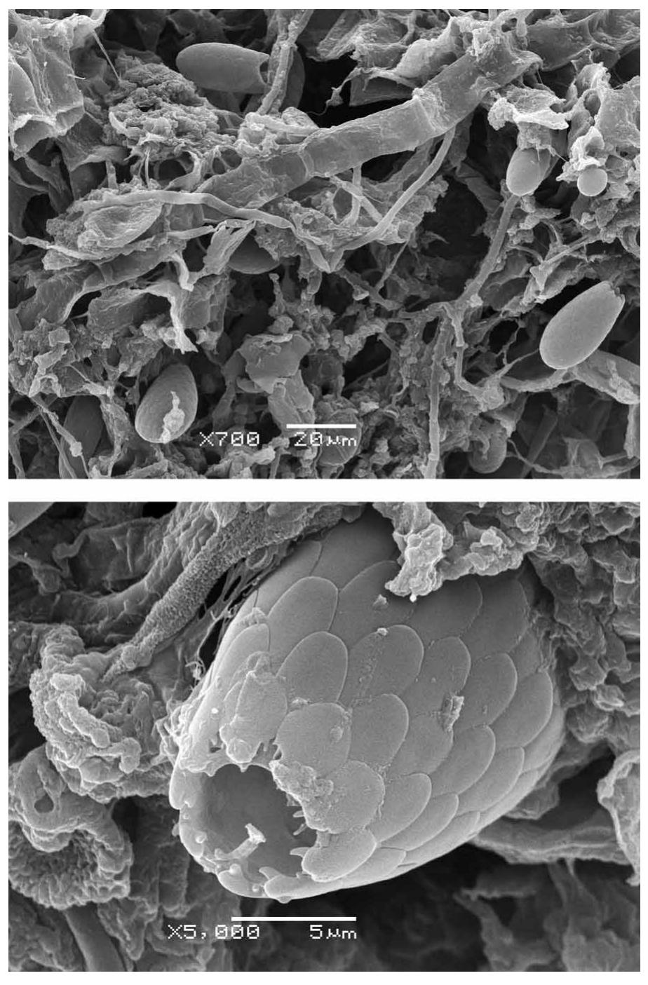 | scanning electron micrograph of biofilm developed in the