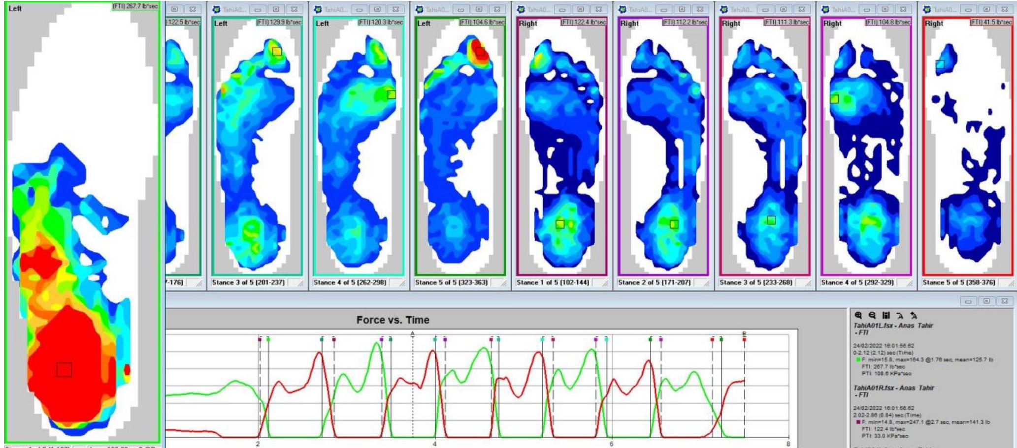 Real-time heatmaps of both feet for various stances during