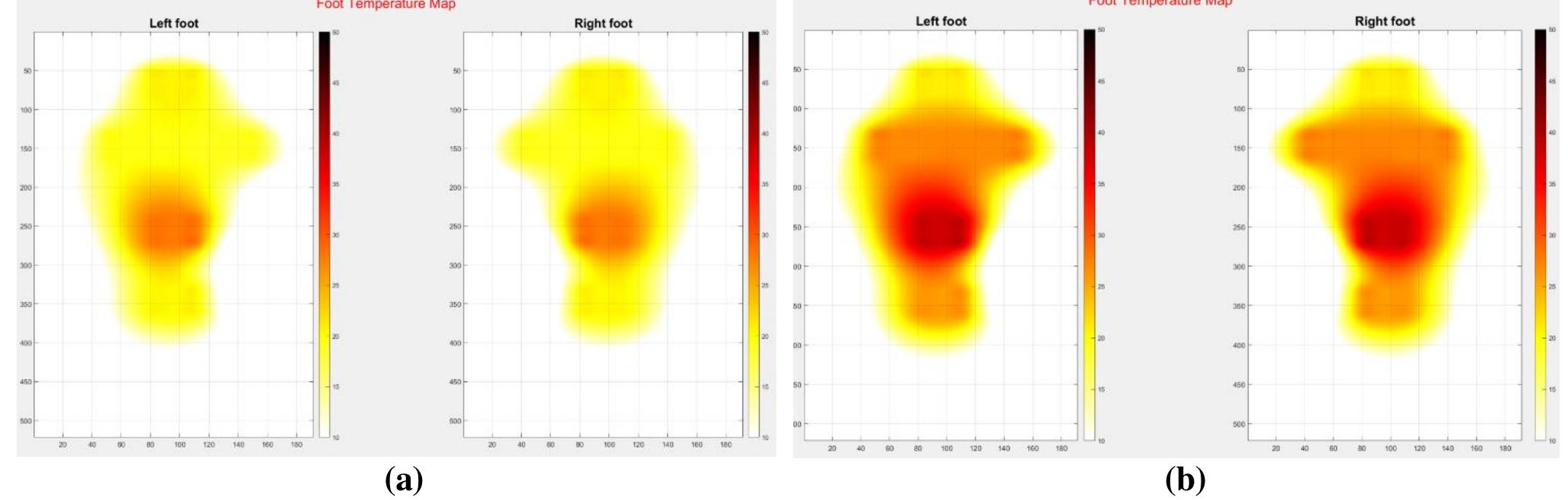 Real-time heatmaps of both feet for various stances during