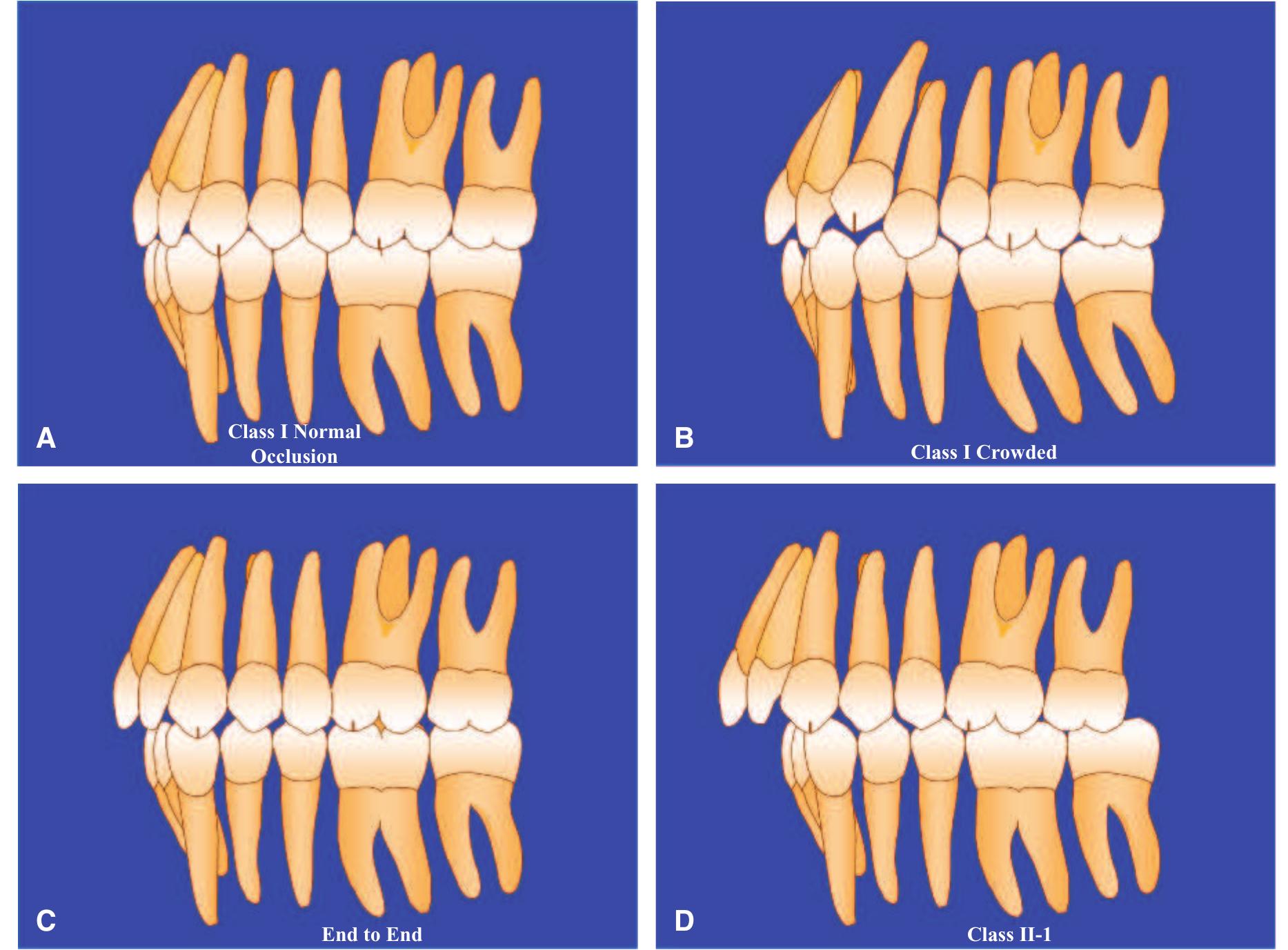 (PDF) Orthodontic Diagnosis and Treatment Planning