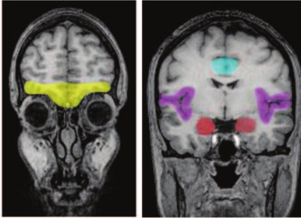 (PDF) Emotion, cognition, and behavior