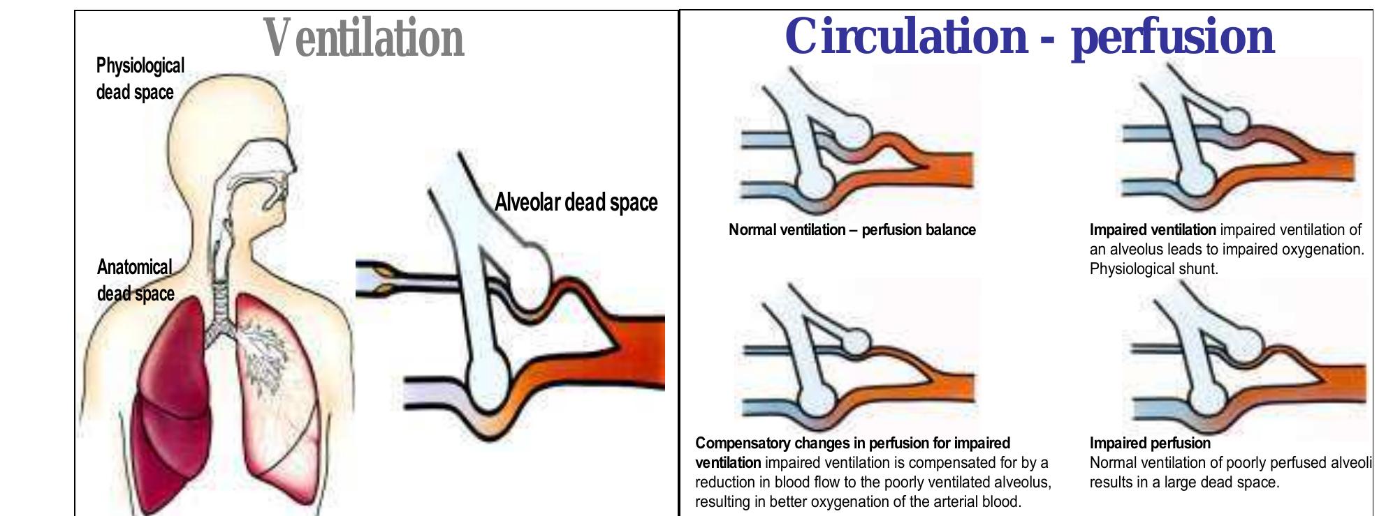 What is Dead Space Ventilation: Essential Insights You Need Today