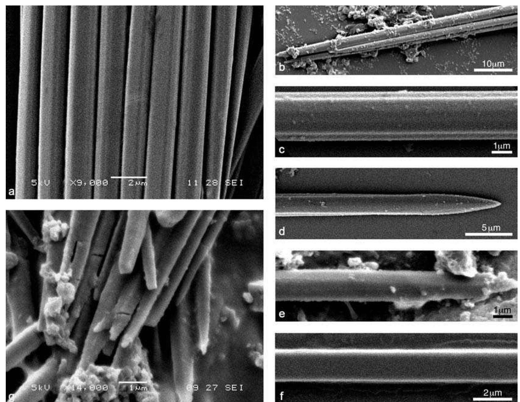 (PDF) Morphometric analysis of calcium oxalate raphides and assessment ...