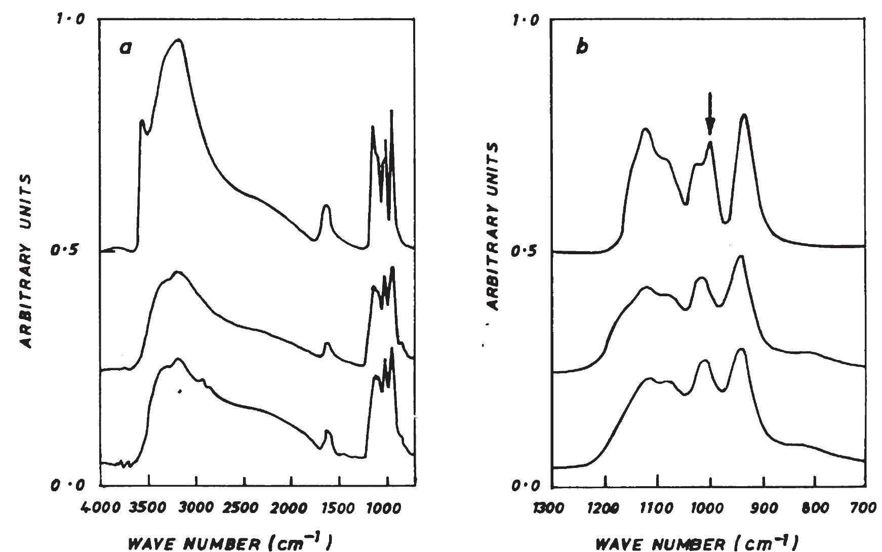 X-ray diffraction pattern of zinc phosphate coating formed