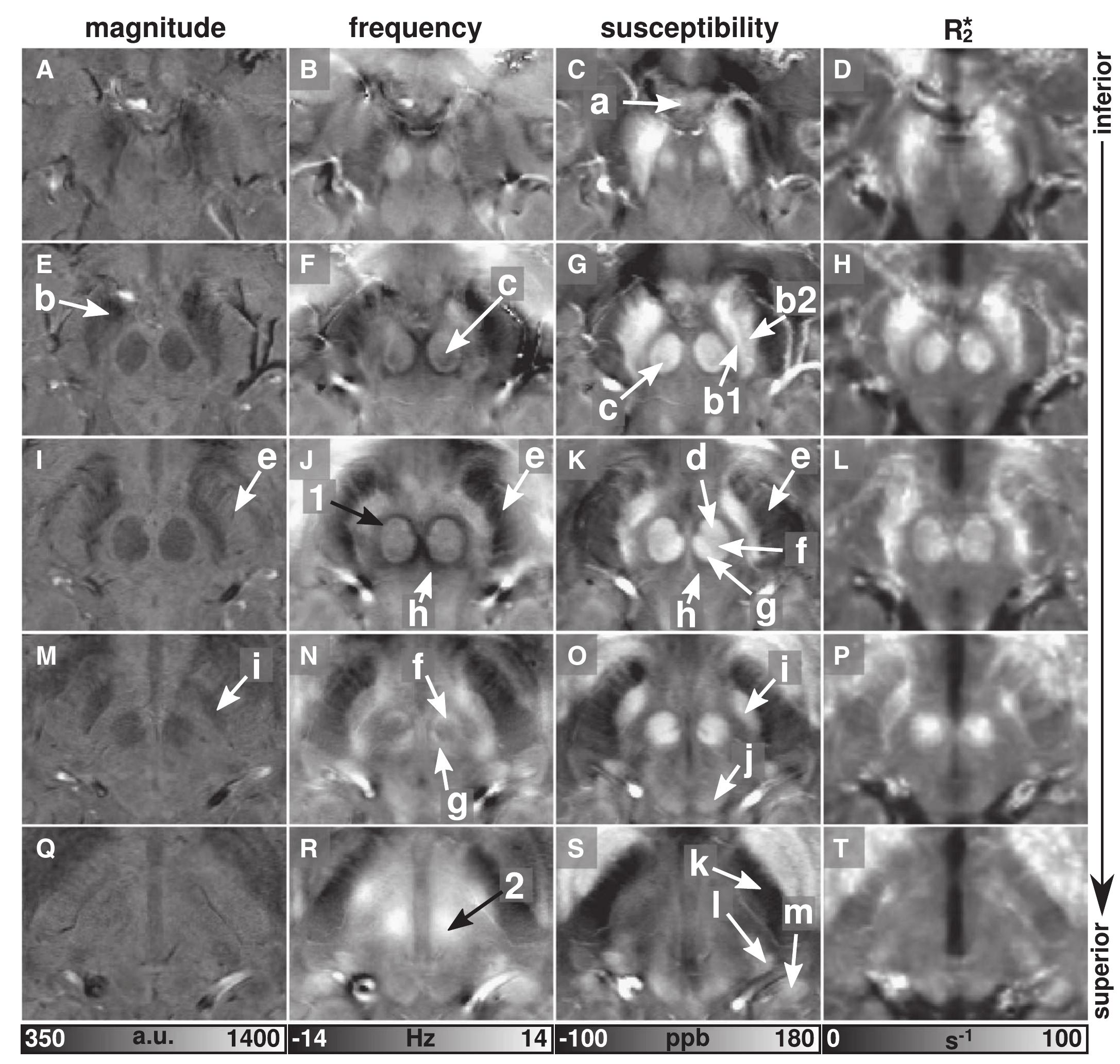 Fig. 1. Gradient-echo imaging of the midbrain. Average intensity projections (projection length 1.2 mm) of magnitude, frequency, susceptibility, and RS images are displayed in the first, second, third, and fourth column from left, respectively. The rows from top to bottom sample the midbrain from inferior to superior direction with a slice separation of 1.2 mm Average intensity projections were computed to cover tissue variations typically visible in images with slice thicknesses of 1.2 mm. The white arrows indicate a — mammillary body, b — substantia nigra, b1 — substantia nigra pars reticulata, b2 — substantia nigra pars compacta, c — red nucleus pars caudalis, d — red nucleus pars oralis, e — crus cerebri f — medullary lamella of red nucleus, g — red nucleus pars dorsomedialis, h — central tegmental tract, i— subthalamic nucleus, j — superior colliculus, k — internal capsule, | — media’ geniculate nucleus, and m — lateral geniculate nucleus. Non-local signal contributions on frequency maps are marked by black arrows (1,2). 